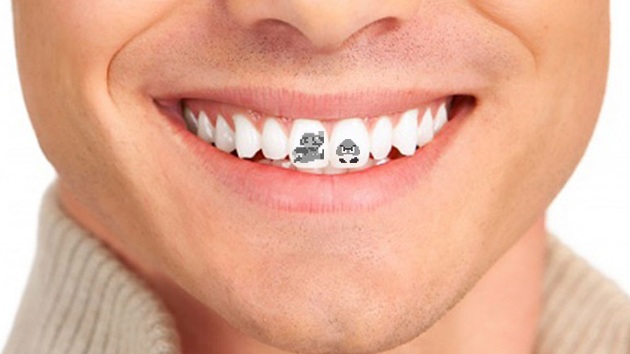 Cove denti